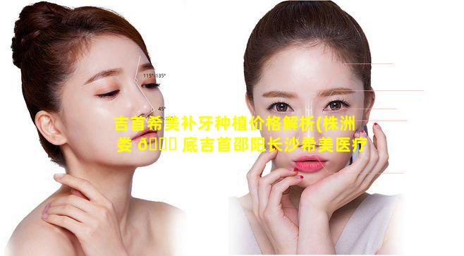 吉首希美补牙种植价格解析(株洲娄 🐟 底吉首邵阳长沙希美医疗美容正规吗)